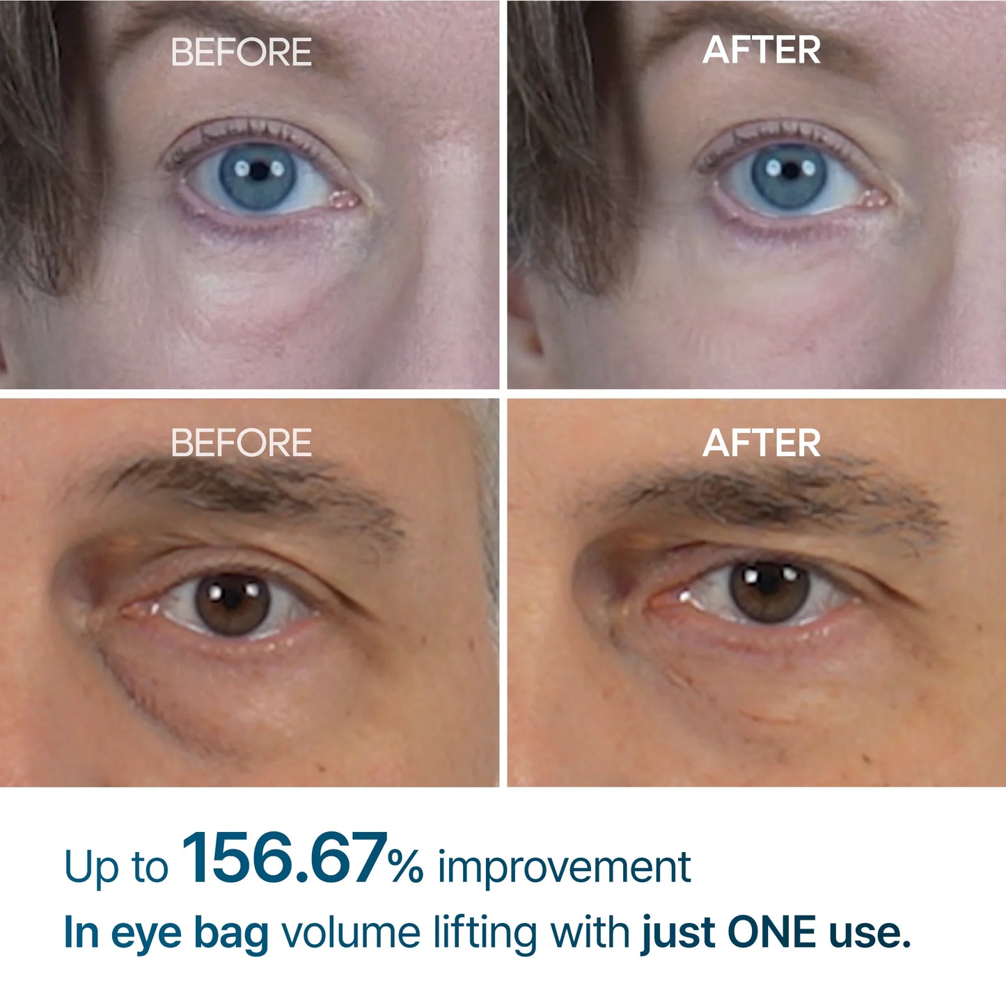 Brillion Radiance: Eye Cream for Bright, Bag-Free Eyes
